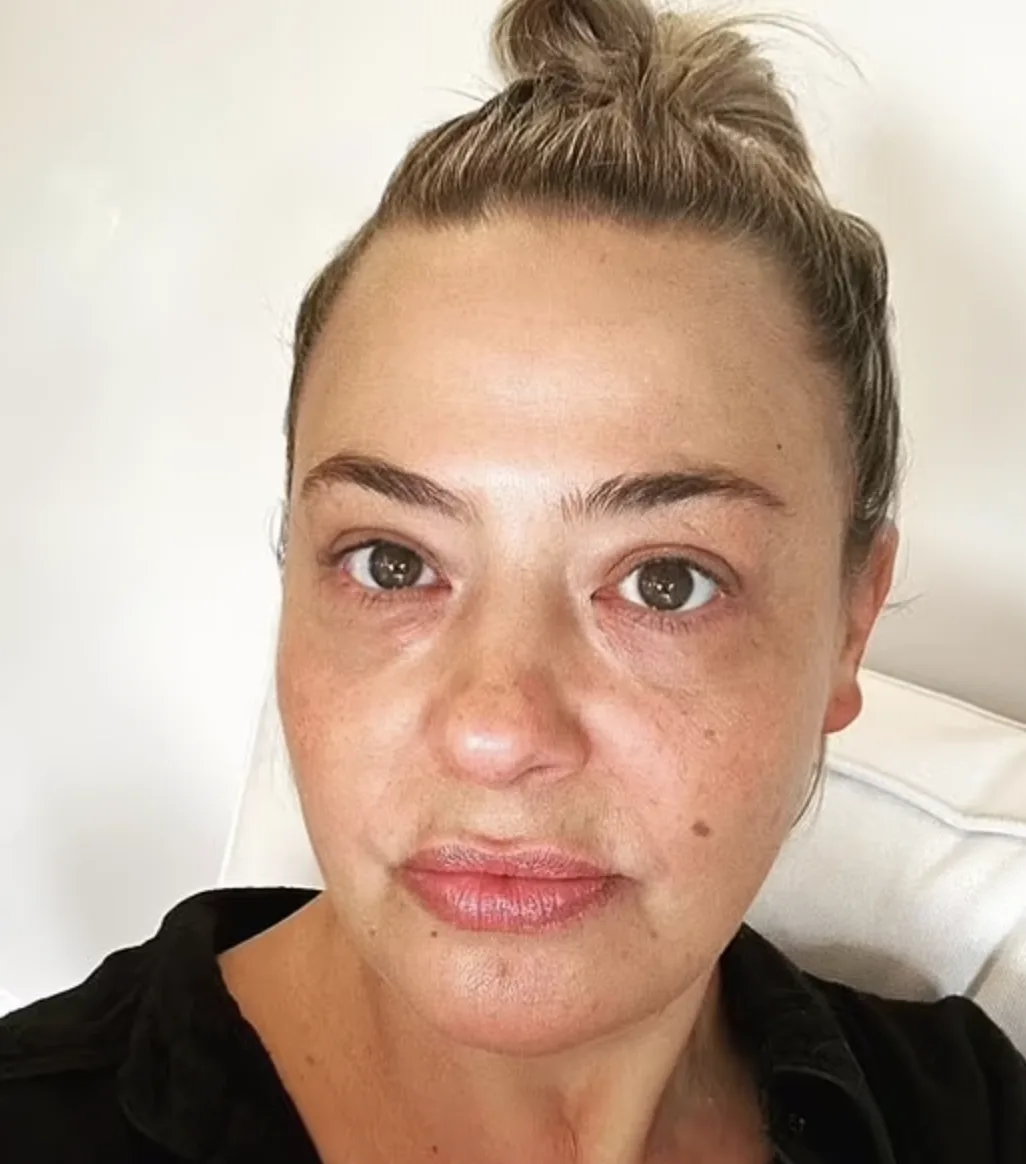 Lisa Armstrong Mourns Dad as Ex Ant McPartlin Welcomes Baby Son Wilder