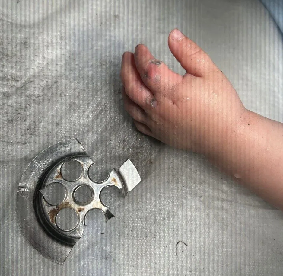 Firefighters Cut Plughole to Free Toddler’s Fingers in Birmingham Hospital Rescue