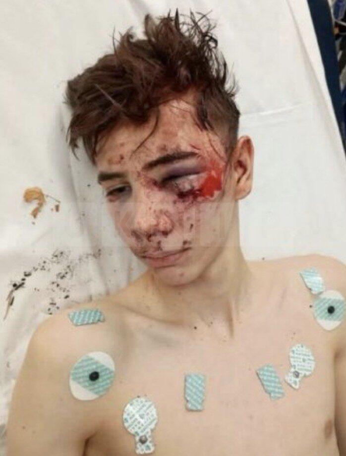 Four arrested after moped crash outside Crook Log restaurant in Bexleyheath