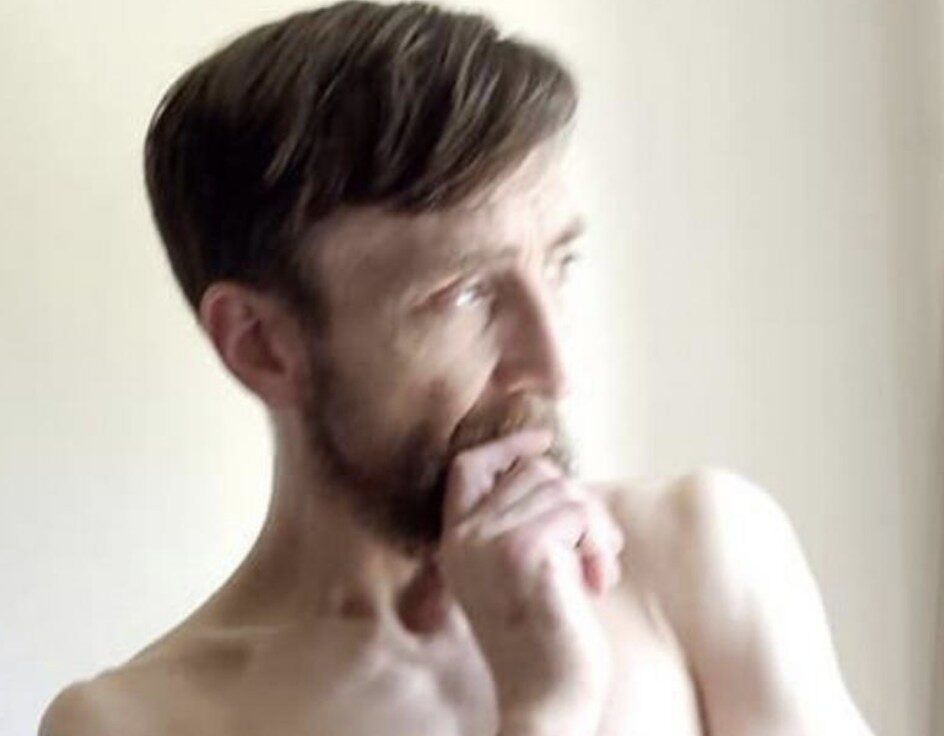 Man Dies Choking After Police Confrontation in Dagenham Car Park