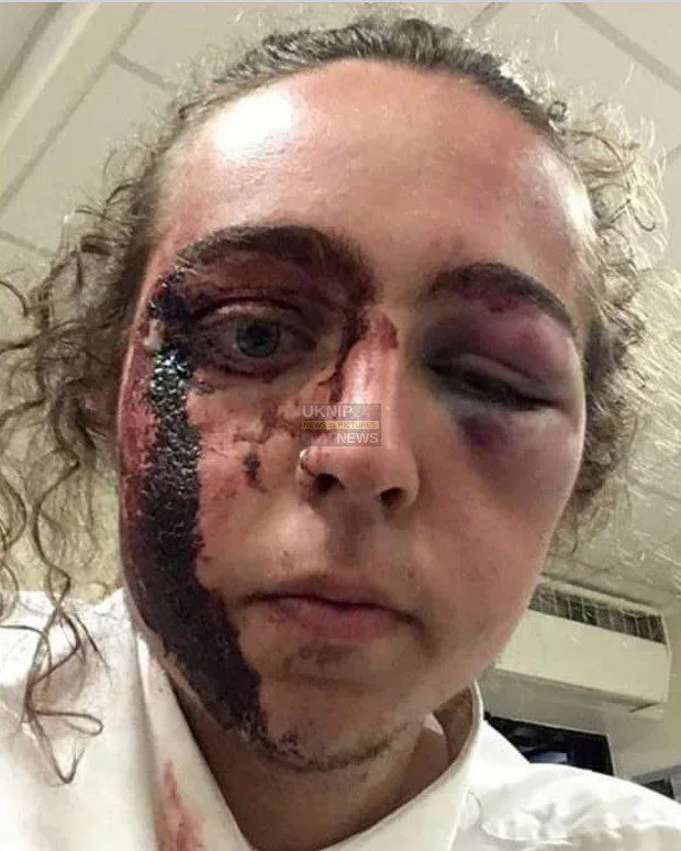 Enough is Enough as Havant Gang film attack on Youngster on Mobile Phones