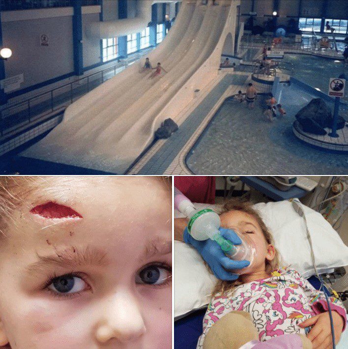 Family Holiday at Butlin’s turns into a real Life Nightmare as Child is Rushed to Hospital with Head Injury