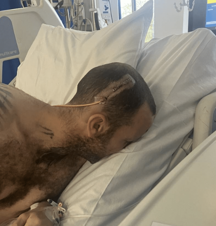 From Brain Bleed to Ultra Marathon: Man Takes on 50km Challenge for Charity