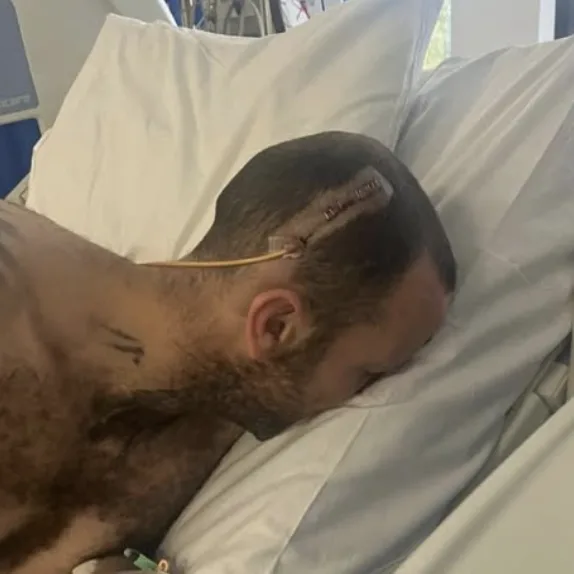 Brain Bleed Survivor Stuart Tackles 50km New Forest Ultra to Raise Cash for Headway Charity