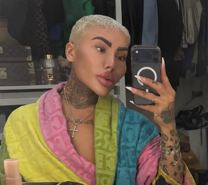 Two Bailed After Arrest Over ‘Lip King’ Jordan James Parke’s Death in Canary Wharf Cosmetic Procedure