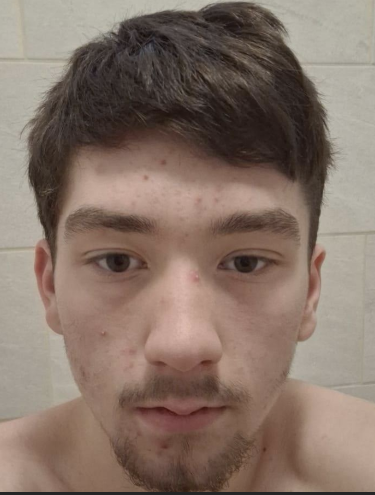 Teenager Vanishes from Canterbury: Police Launch Urgent Search