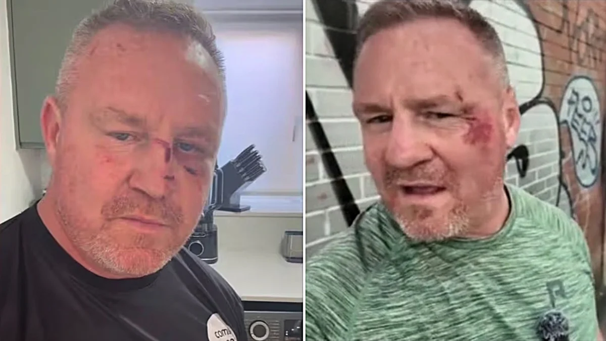 YouTuber Billy Moore Injured in Manchester Pothole Fall Slams Mayor Burnham