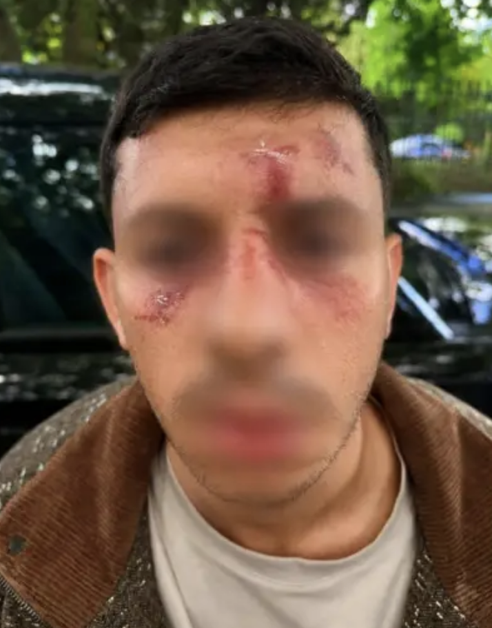 Israeli Man Beaten Unconscious In Antisemitic Attack Golders Green