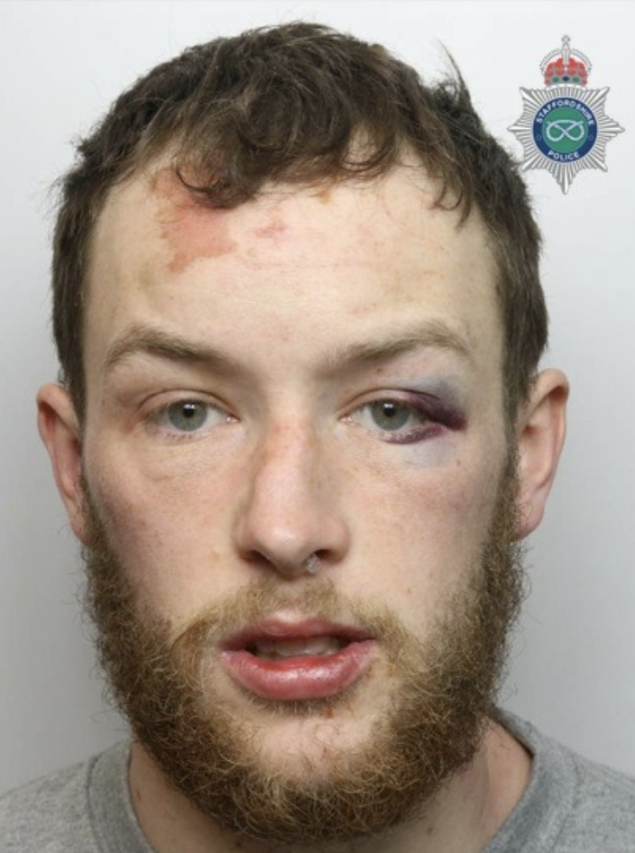 Burton-on-Trent Man Jailed for Knife Assault Causing Facial Injuries