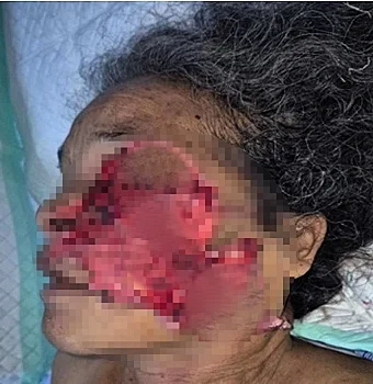 68-Year-Old Woman Mauled by Bear in South Sumatra Plantation Attack