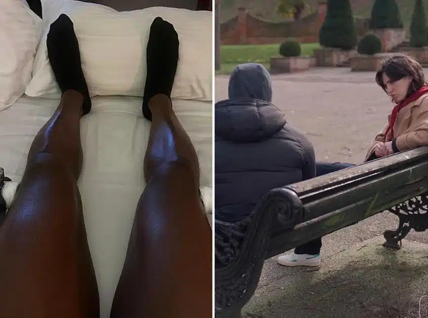 UK Man Spends £20k on Limb-Lengthening Surgery to Gain 7cm Height