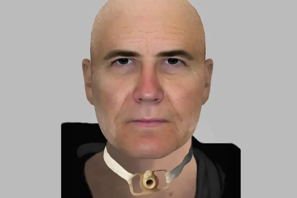 Police Seek Bald Man With Tracheotomy Tube After Doncaster Assault