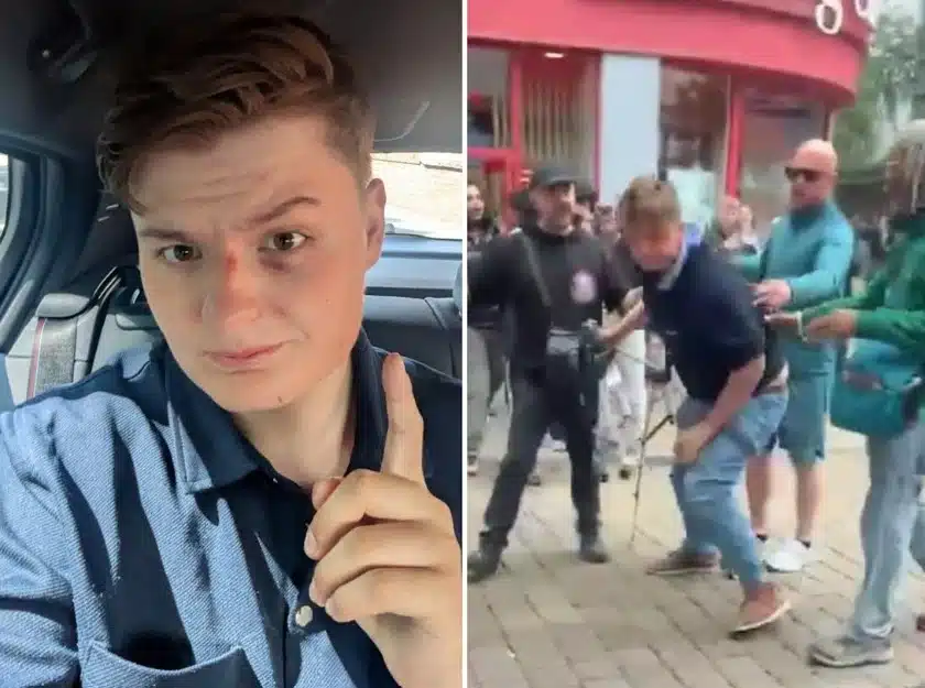 Young Bob Calls Manchester Assault ‘Most High-Profile Case’ Says Police