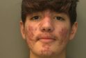 Brighton Teenager Sentenced to Life for Fatal Stabbing