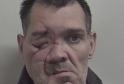 Prolific Burglar Locked Up After Serious Car Crash and String of Thefts